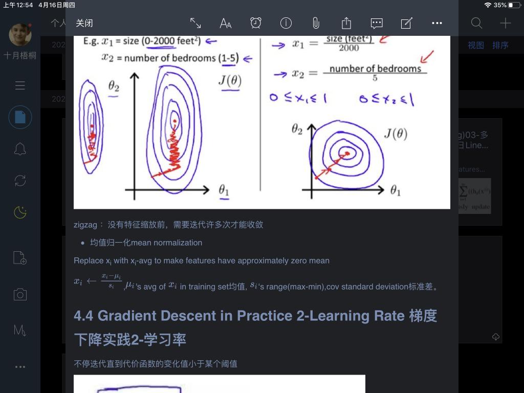 女性抹胸开襟哺乳衣的注意事项